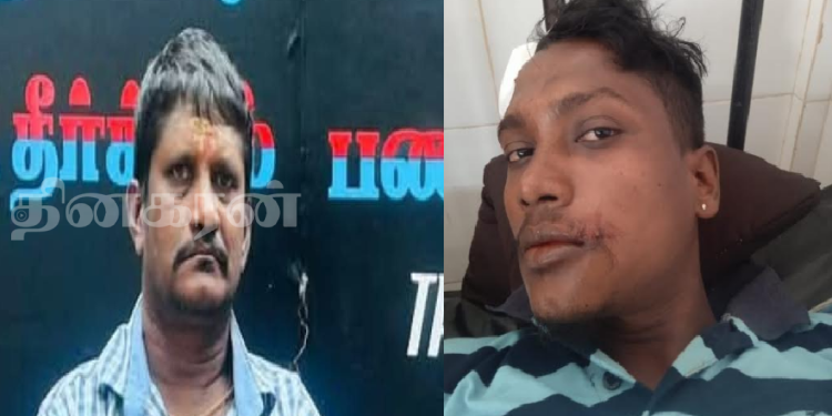 யாழ்ப்பாணத்தில் விபத்தில் படுகாயமடைந்த முதியவர் உயிரிழப்பு!