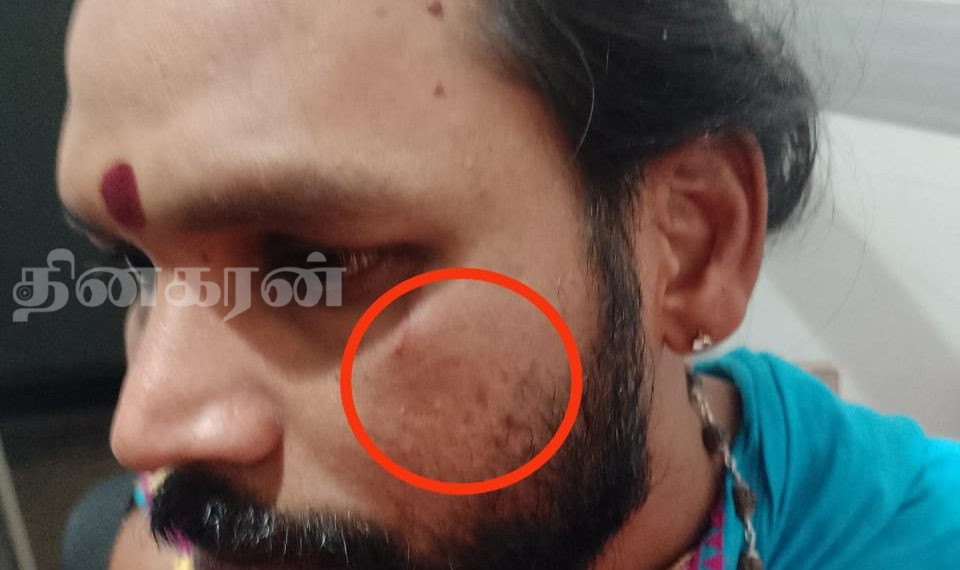 இந்து மதகுரு மீது தாக்குதல் – அருட்கலாநிதி றமேஷ் அமதி அடிகளார் கண்டனம்!