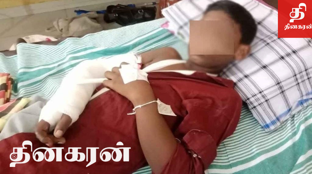 யாழில் மாணவனை உந்துருளியால் மோதி விபத்தை ஏற்படுத்திவிட்டு தப்பிச் சென்ற பெண்.!