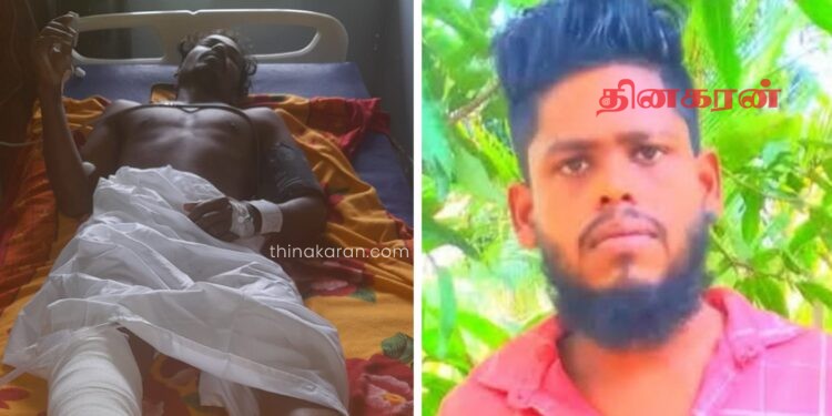 தகாத உறவு தொடர்பில் மனைவியிடம் கேள்வி எழுப்பிய கணவர் கொடூரமாக தாக்கப்பட்டார்!